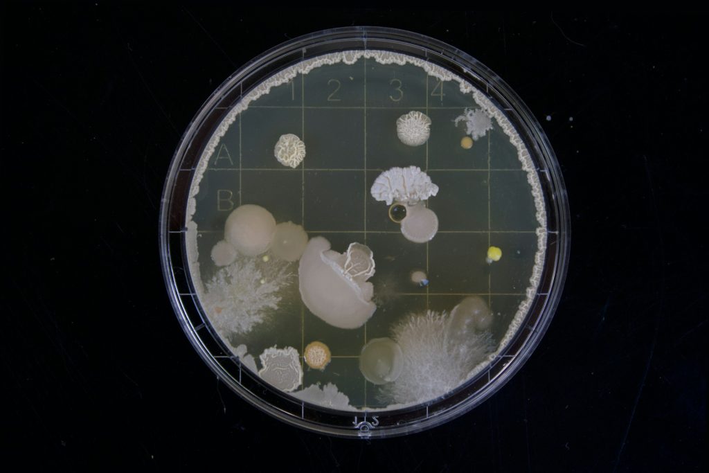 mold in a petri dish